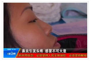 河南电视台民生频道：鼻炎引发头疼，感冒不可大意