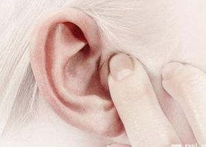 搏动性耳鸣是怎么回事，怎么治？